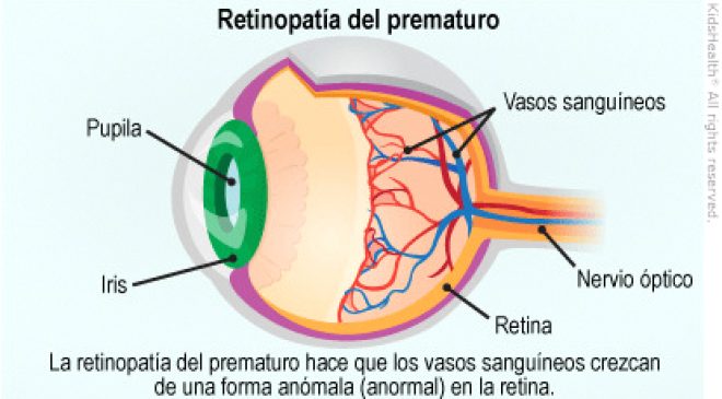 En el HRRG se realizó con éxito una compleja cirugía ocular infantil